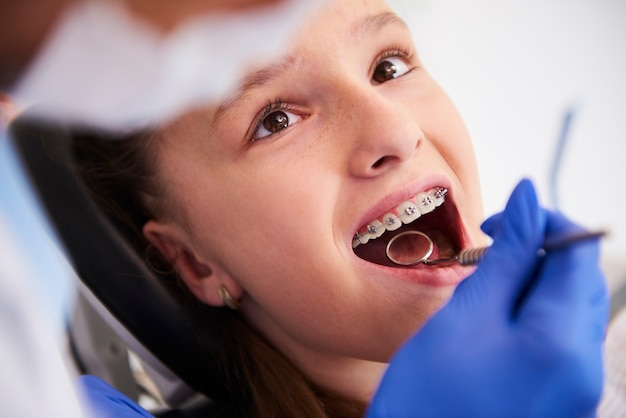 girl-with-braces-during-routine-dental-examination_329181-17710